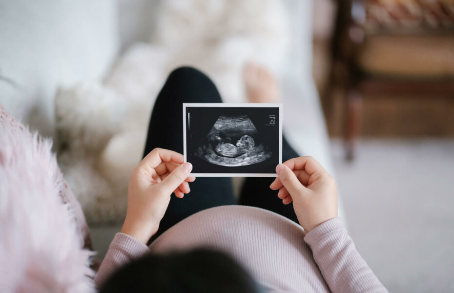 Raskaana oleva nainen katselee käsissään olevaa ultrakuvaa vauvasta.